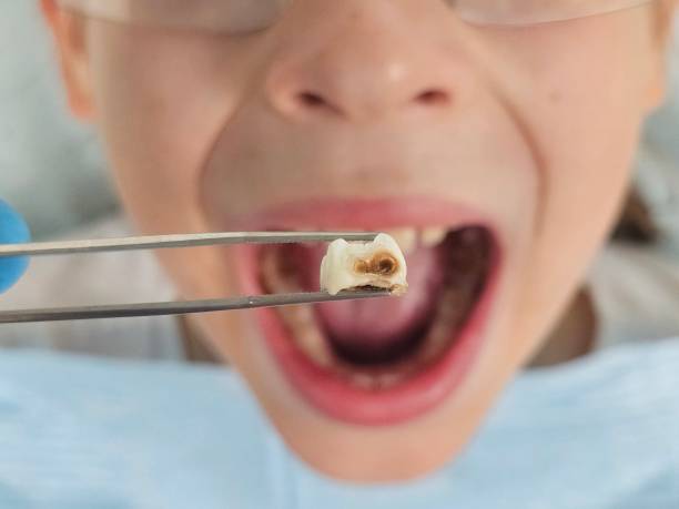 Emergency Dentist for Kids in PA